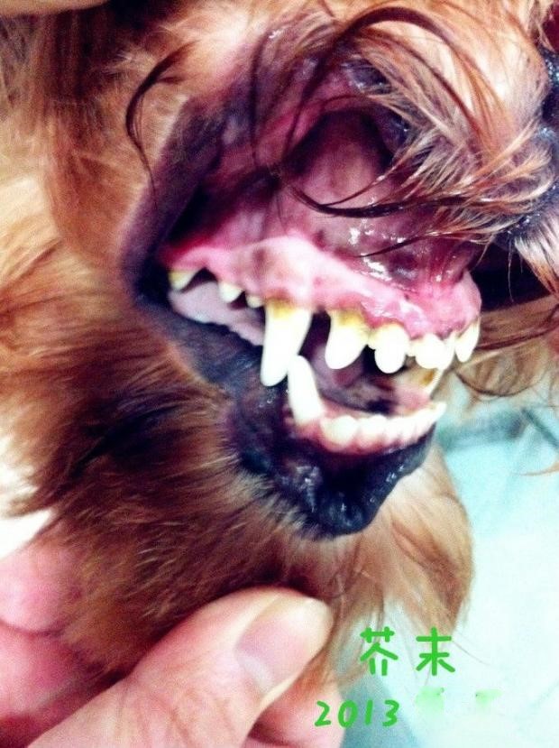 图中的犬牙根部发黄,已经是第二期的牙结石问题,可以通过刷牙和漱口