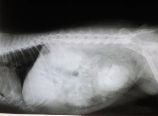  X光片，一个病例中膀胱内结石。