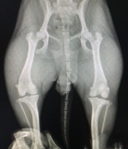 图2  X光检查显示髌骨脱出滑车