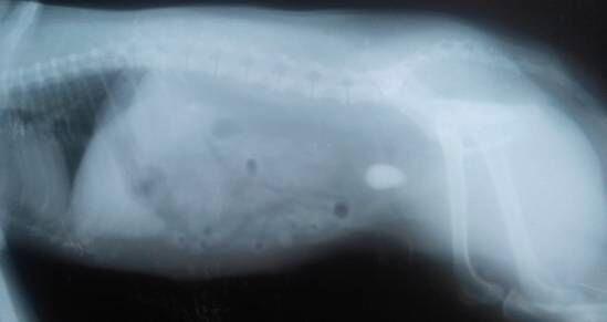 X光下，另一个病例中膀胱内结石。