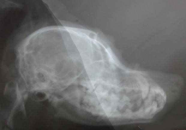 图3  X光片显示颅骨完整，无异物残留