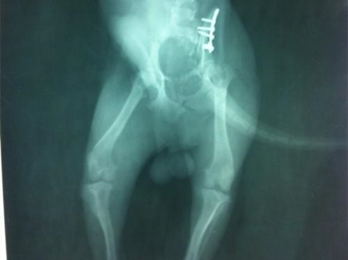  复位后的X光片，腹背位，可见明显植入的骨板