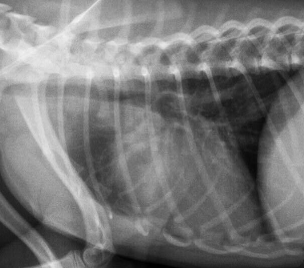 X-光影像显示肺部感染