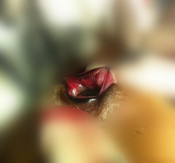 这是阿kan手术中的照片，使用的是包埋术。