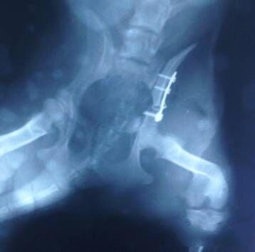 流浪犬髂骨植入钢板固定物，对于胫腓骨骨头错位外固定方法。